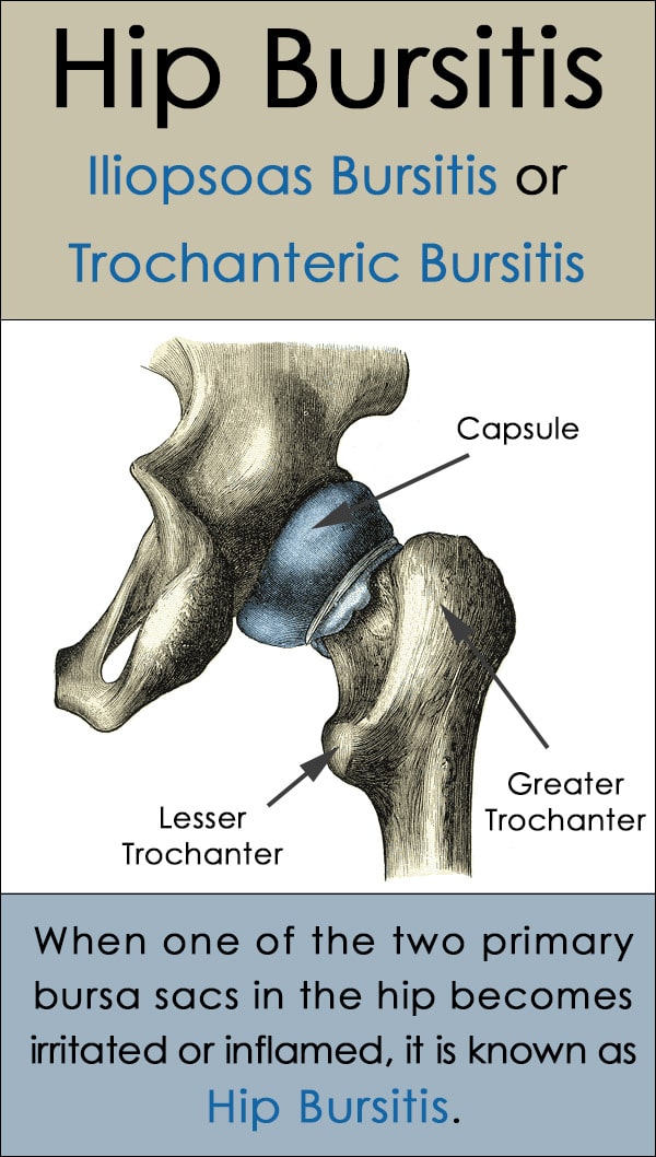 Hip Bursitis, Conditions Treated