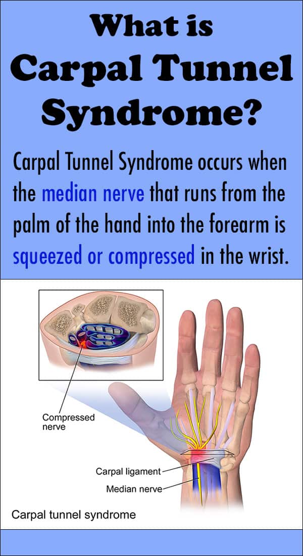 Carpal Tunnel Symptoms, Causes and Treatment